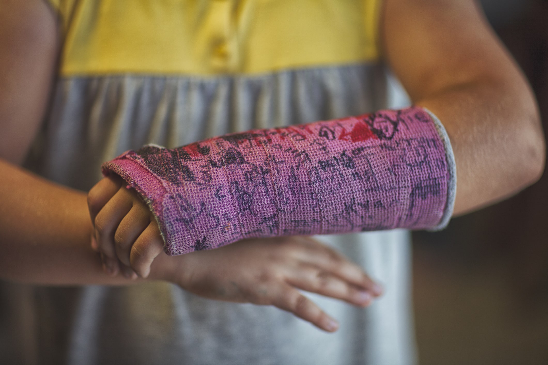 midsection-of-girl-showing-her-signed-arm-cast-exercise-and-mental-health